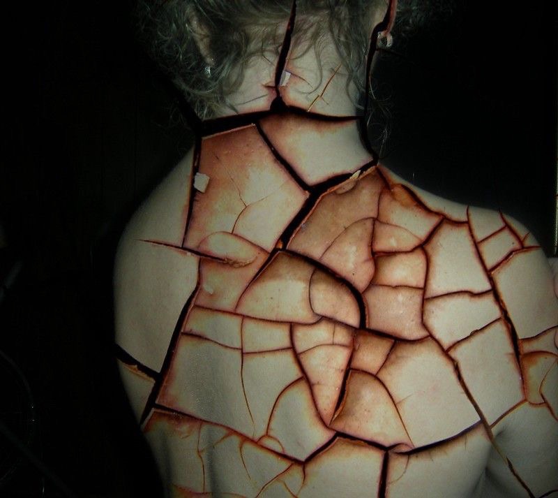 🫀Wrażliwość — skóra